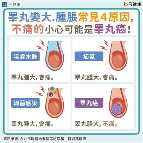 蛋蛋長肉芽|睪丸上竟然長痘痘了、這是怎麼回事？